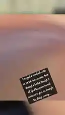 This video follows Melissa through a day in her life, starting with a medical appointment where she receives an IV drip in a hospital room. The scene transitions to her traveling in a car with another person, capturing moments of her daily routine. by @mahreen0182 with mahreen0182 by Original Sound