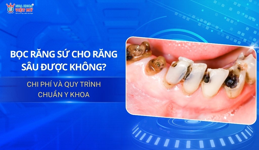 Quy trình bọc răng sứ cho răng sâu: Lời khuyên chăm sóc