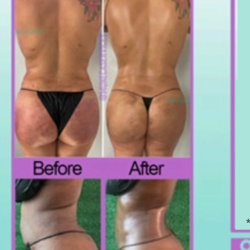 ORLANDO Area Post-Op Treatments